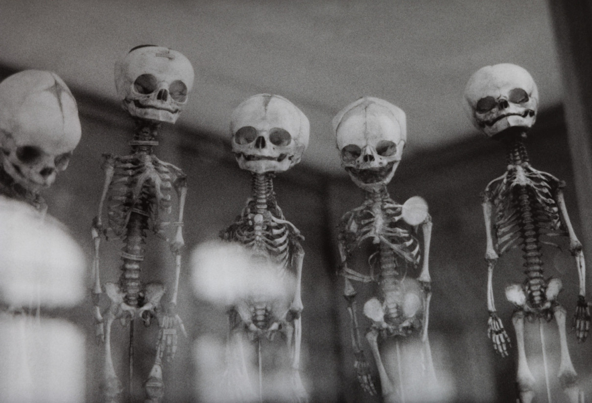 Infants, Paris by Johnny Welch. Photograph of five foetal skeletons inside a museum display cabinet.